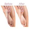 Clinical Before and After Side by Side Feet Contrast Showcasing Dead Skin Elimination and Deep Cracked Heel Repair