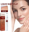Infographic Visual Describing Fast Easy and Effective Liquid Wart Treatment Steps on a Smiling Female Face Model