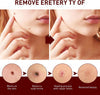 Before and After Comparative Chart Illustrating Skintag Flaw Removals on a Female Neck Skin Layer